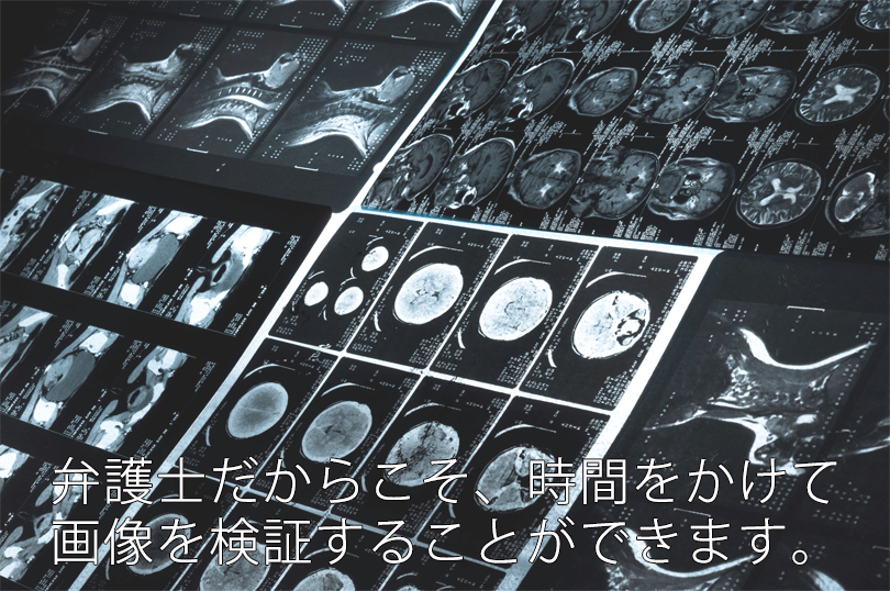 弁護士だからこそ、時間をかけて画像を検証することができます。